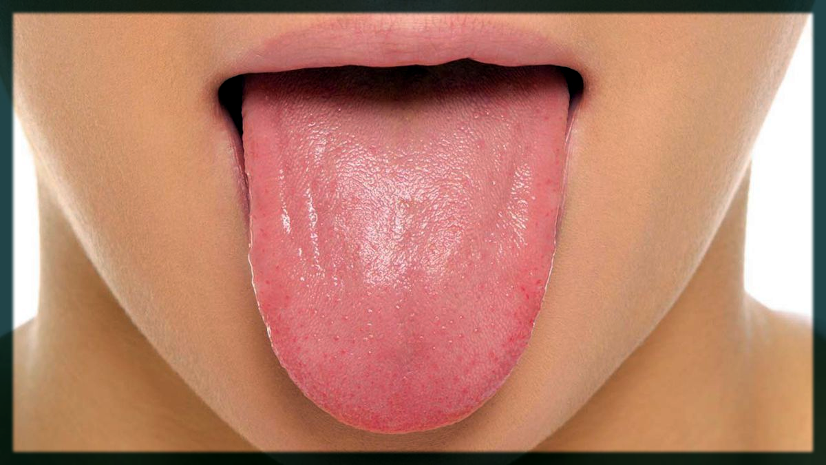Tongue Movement