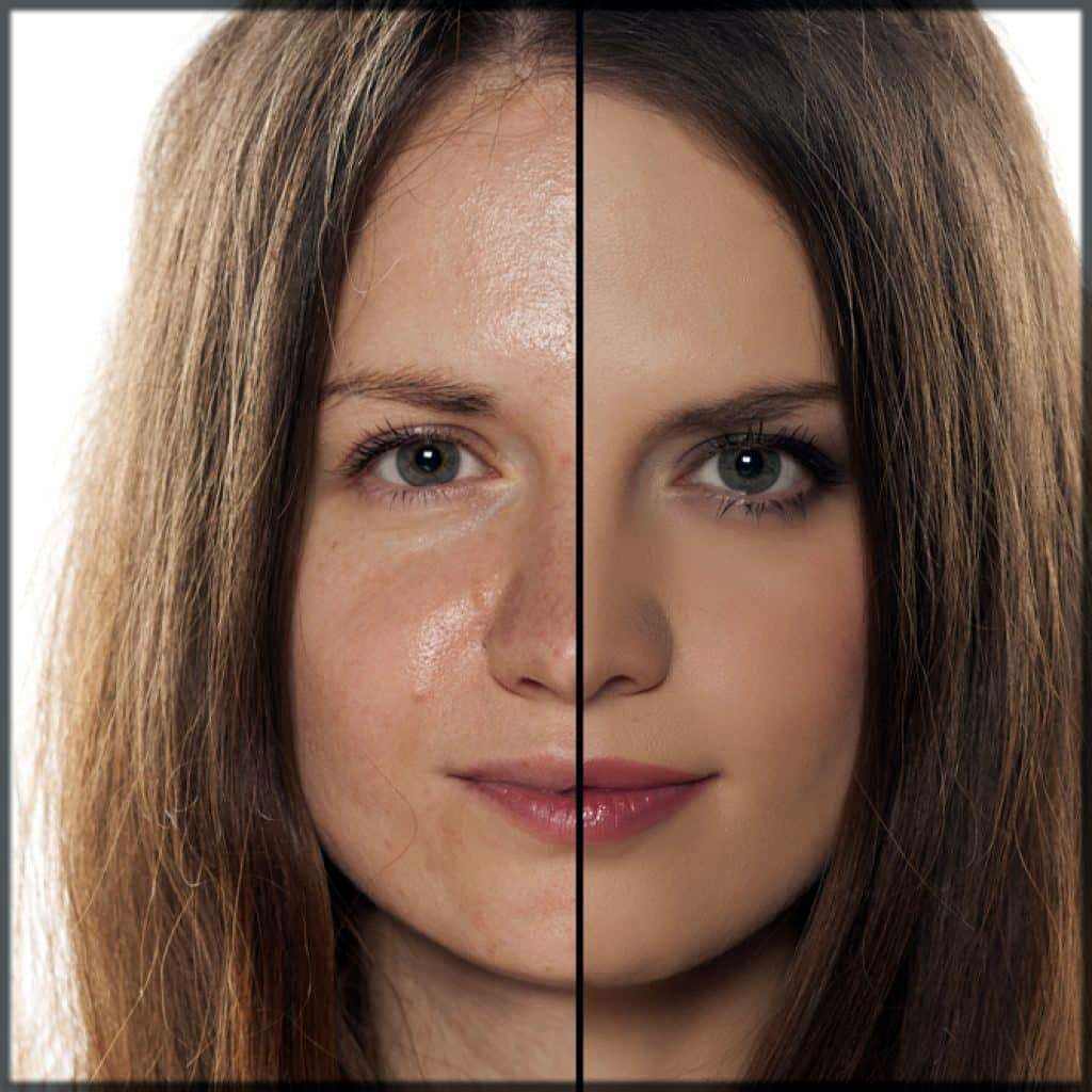 oily skin vs perfect skin