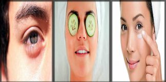 11 Healthy Ways to Reduce Eye Bags - How to Get Rid of Puffy Eyes