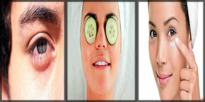 Ways to reduce the eye puffiness