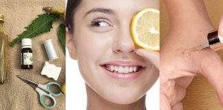 Best Home Remedies to Remove Skin Tags - Skin Tag Removal Creams