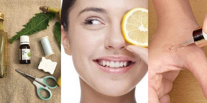 homemade remedies for removing skin tags