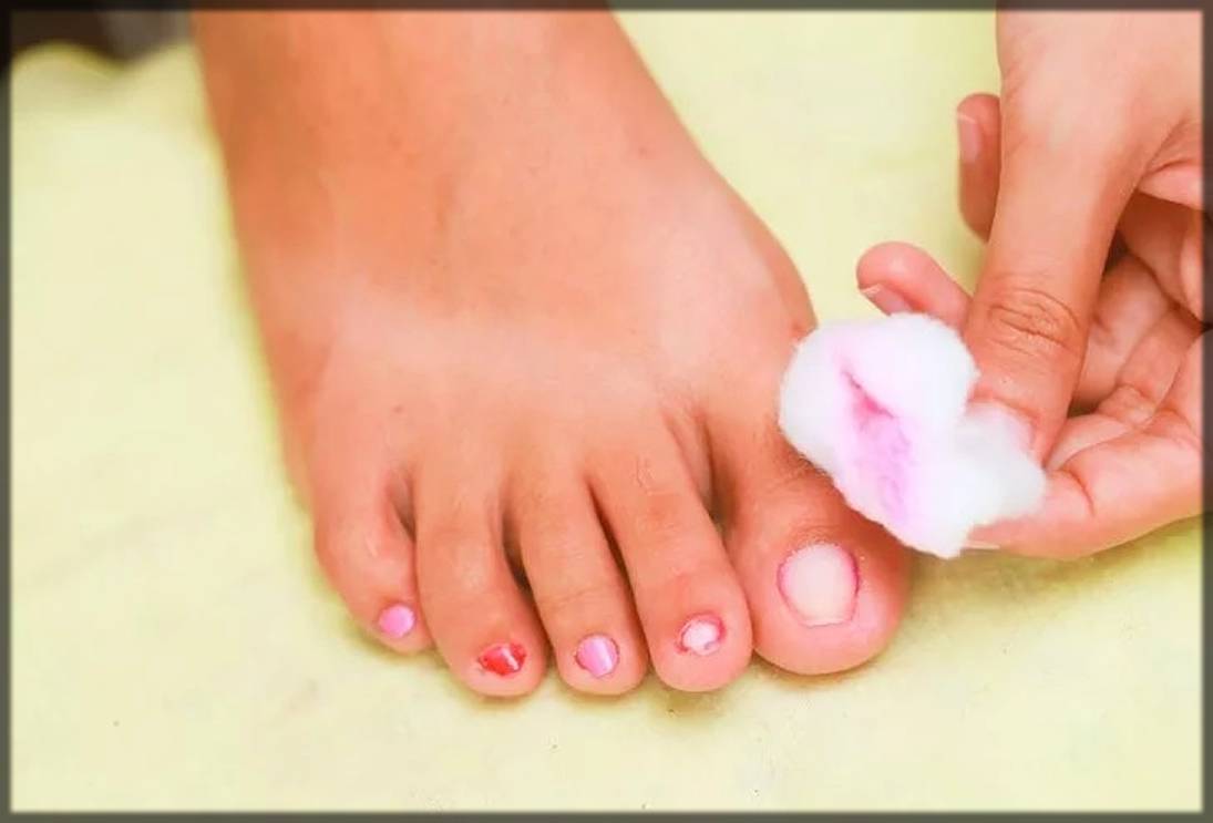 remove old nail polish from feet
